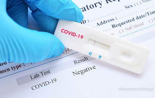 Negatywny test Covid 19 lub szczepienie w 24h